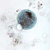 Would anti-e. coli phages make food safe? Pictured is a close up of a cyst of Entamoeba coli, trichrome stain.
