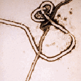 Electron micrograph of Ebola virus.