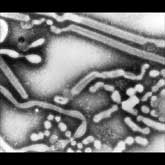 Transmission electron micrograph of influenza A virus, early passage.