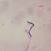 Close up of Streptococcus.