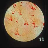 Pictured is a close up of Salmonella Typhosus.