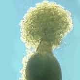 Soybean cyst nematode female (large lemon-shaped) with egg mass. Eggs are also retained inside the female body, which becomes a resistant structure capable of surviving harsh environmental conditions for several years. The diameter of the mature female is approximately 300 micrometers.
